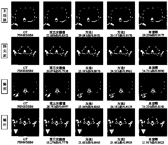 Medical image super-resolution reconstruction method based on dense mixed attention network