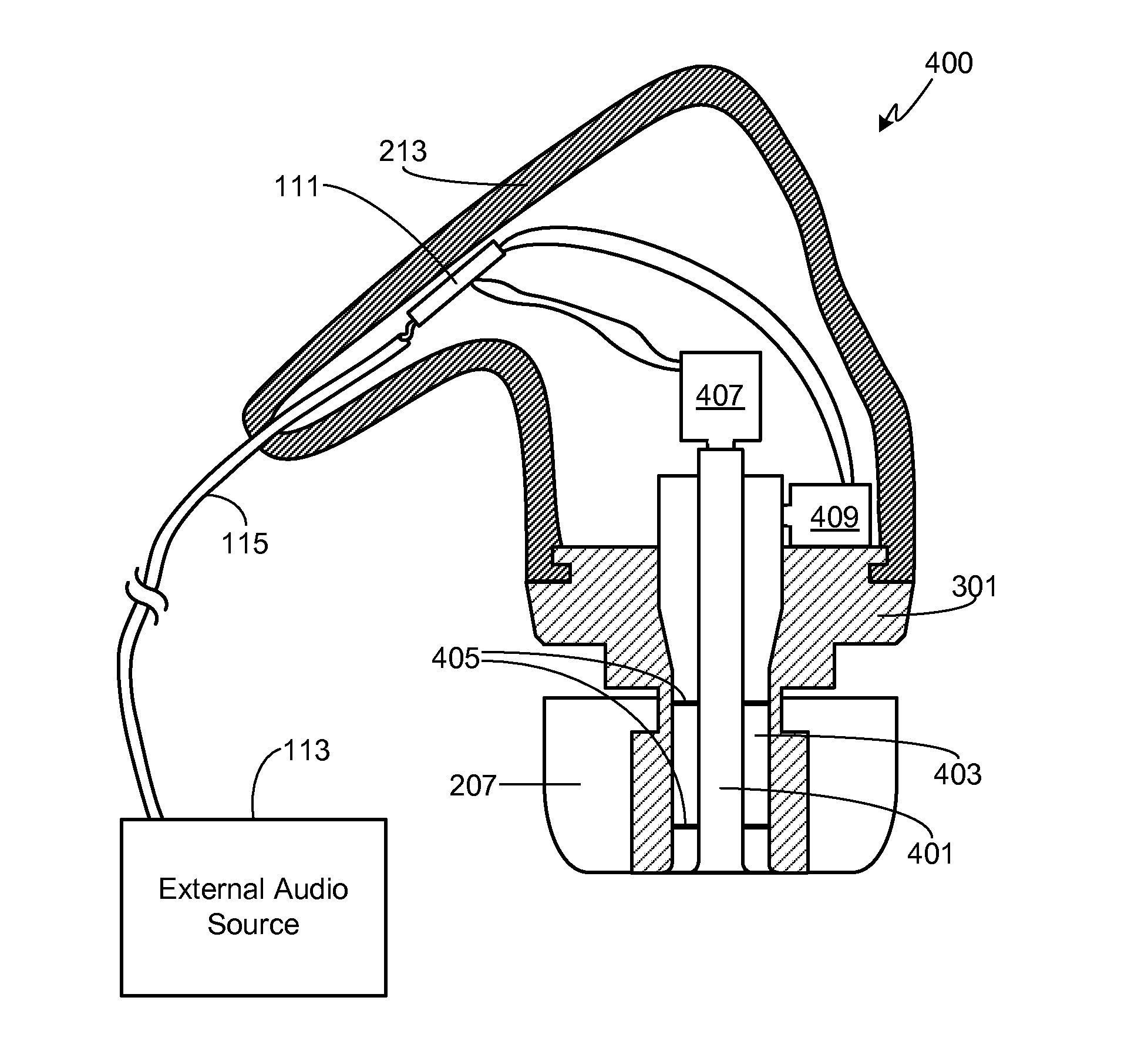 In-Ear Monitor with Triple Sound Bore Configuration