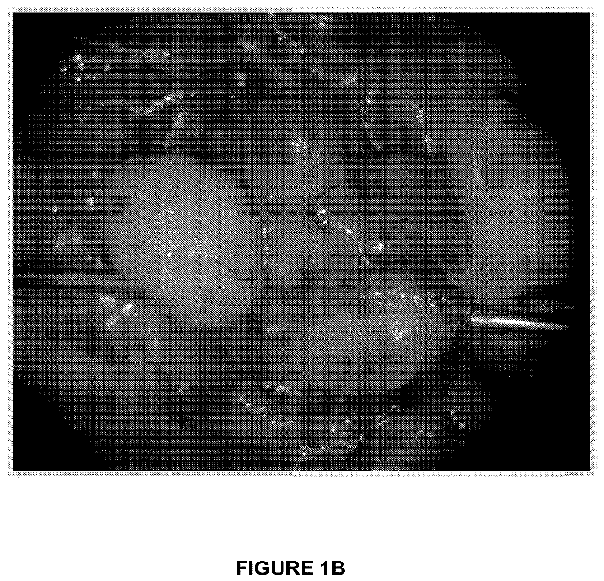 Treatment of H-Ras-driven tumors