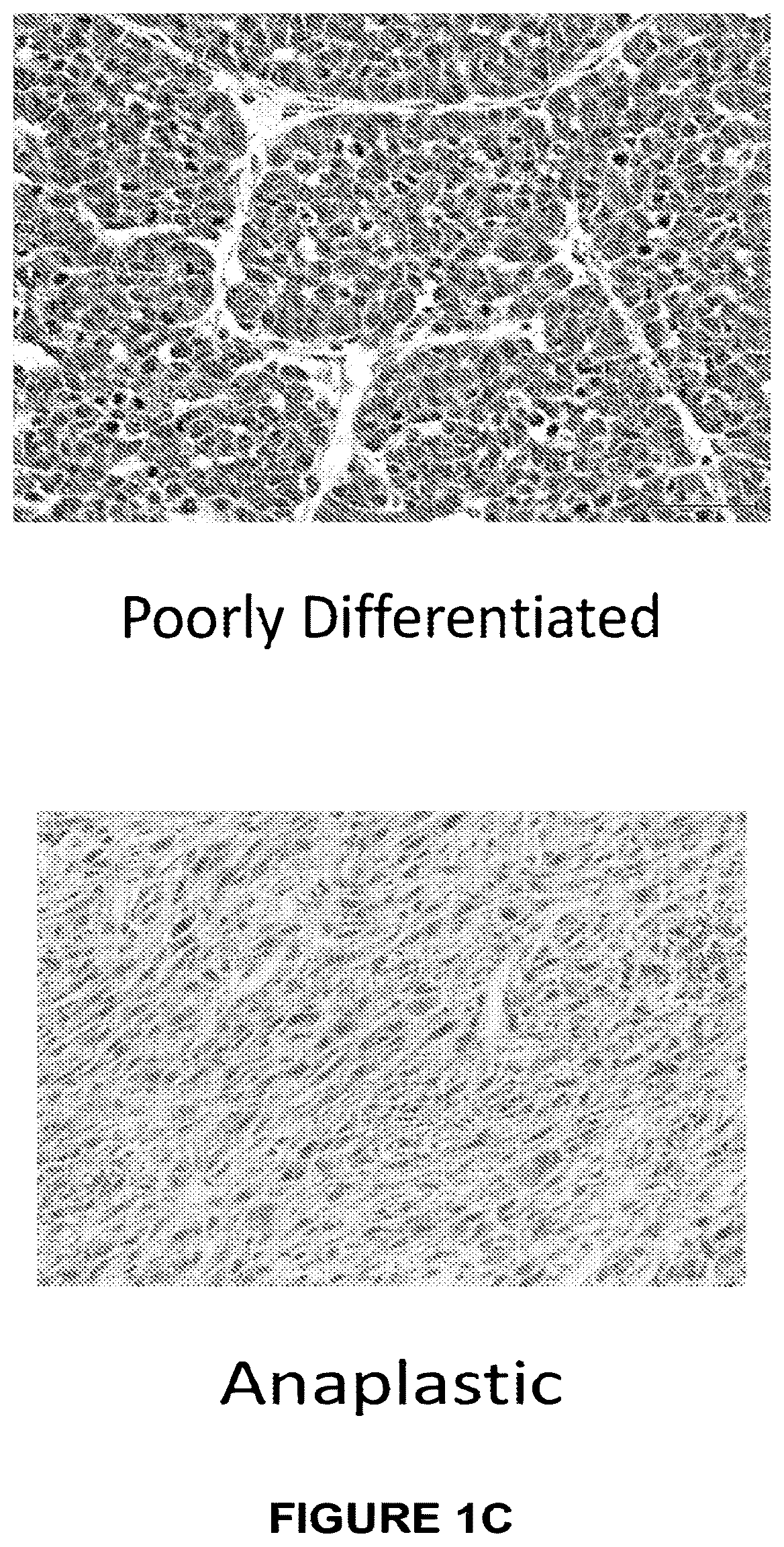 Treatment of H-Ras-driven tumors