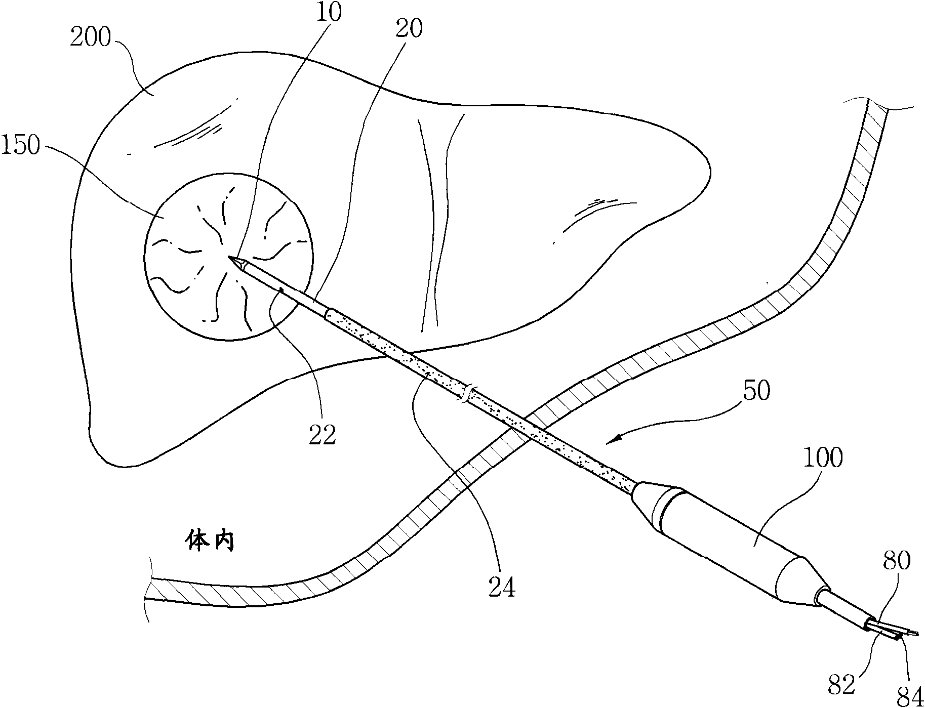 Electrode for radiofrequency tissue