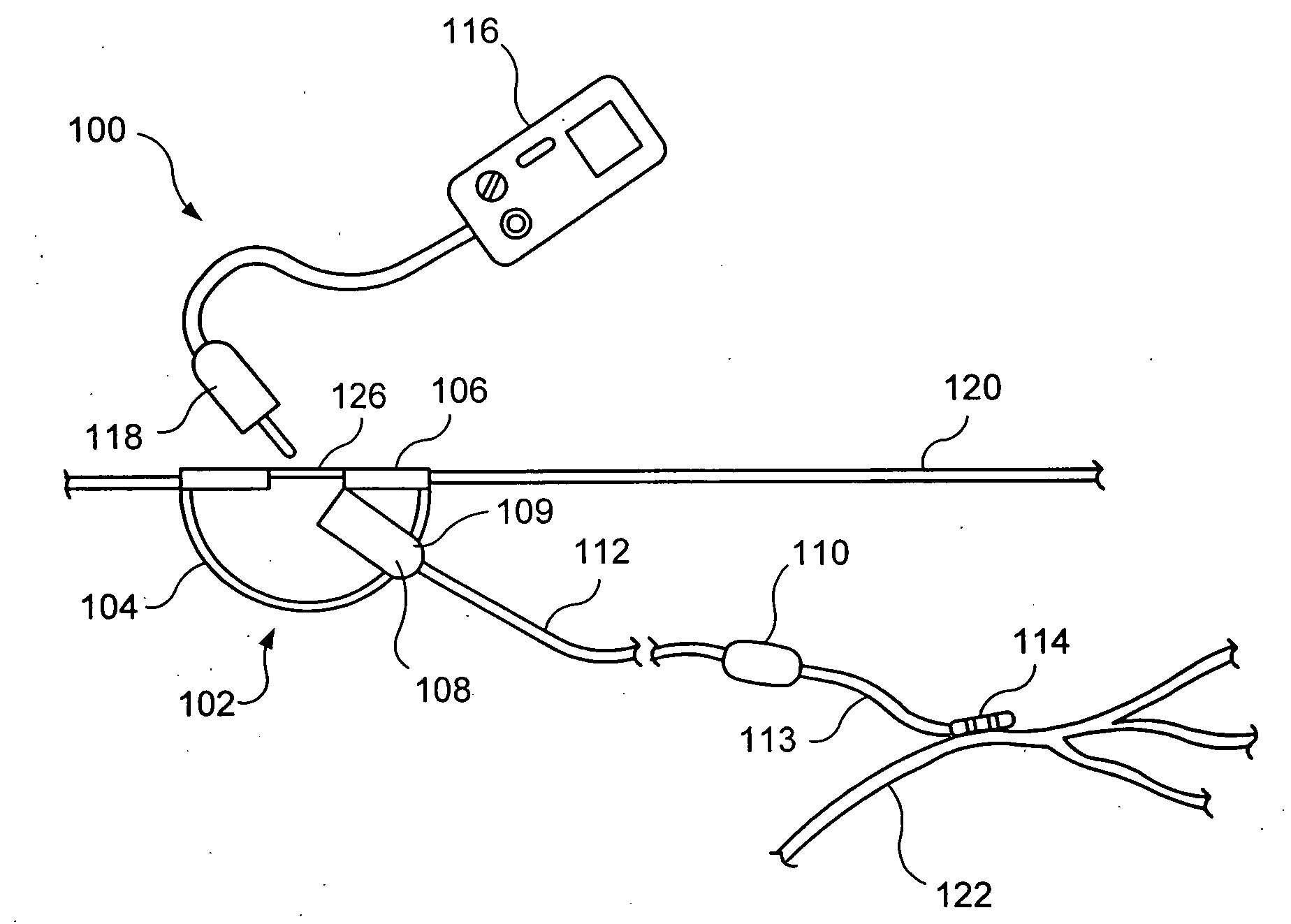 Percutaneous access for neuromodulation procedures