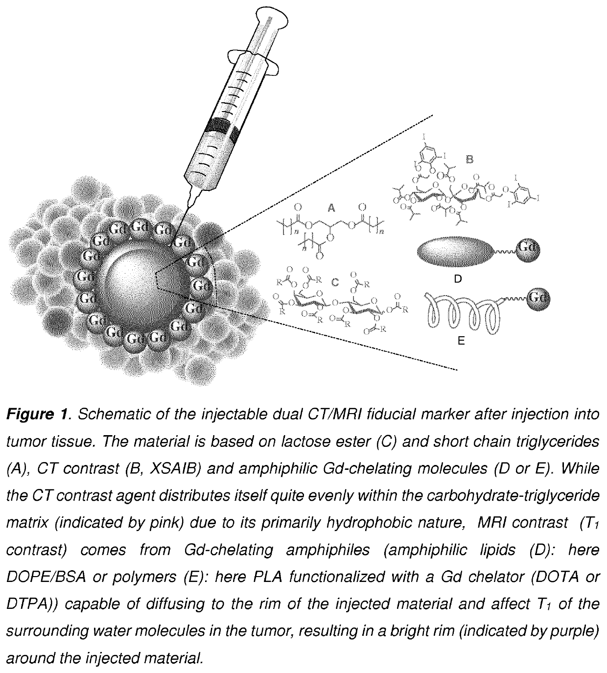 Development of injectable fiducial markers for image guided radiotherapy with dual MRI and CT visibility