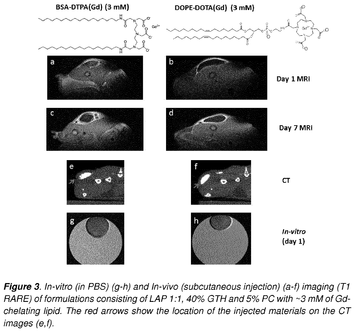 Development of injectable fiducial markers for image guided radiotherapy with dual MRI and CT visibility