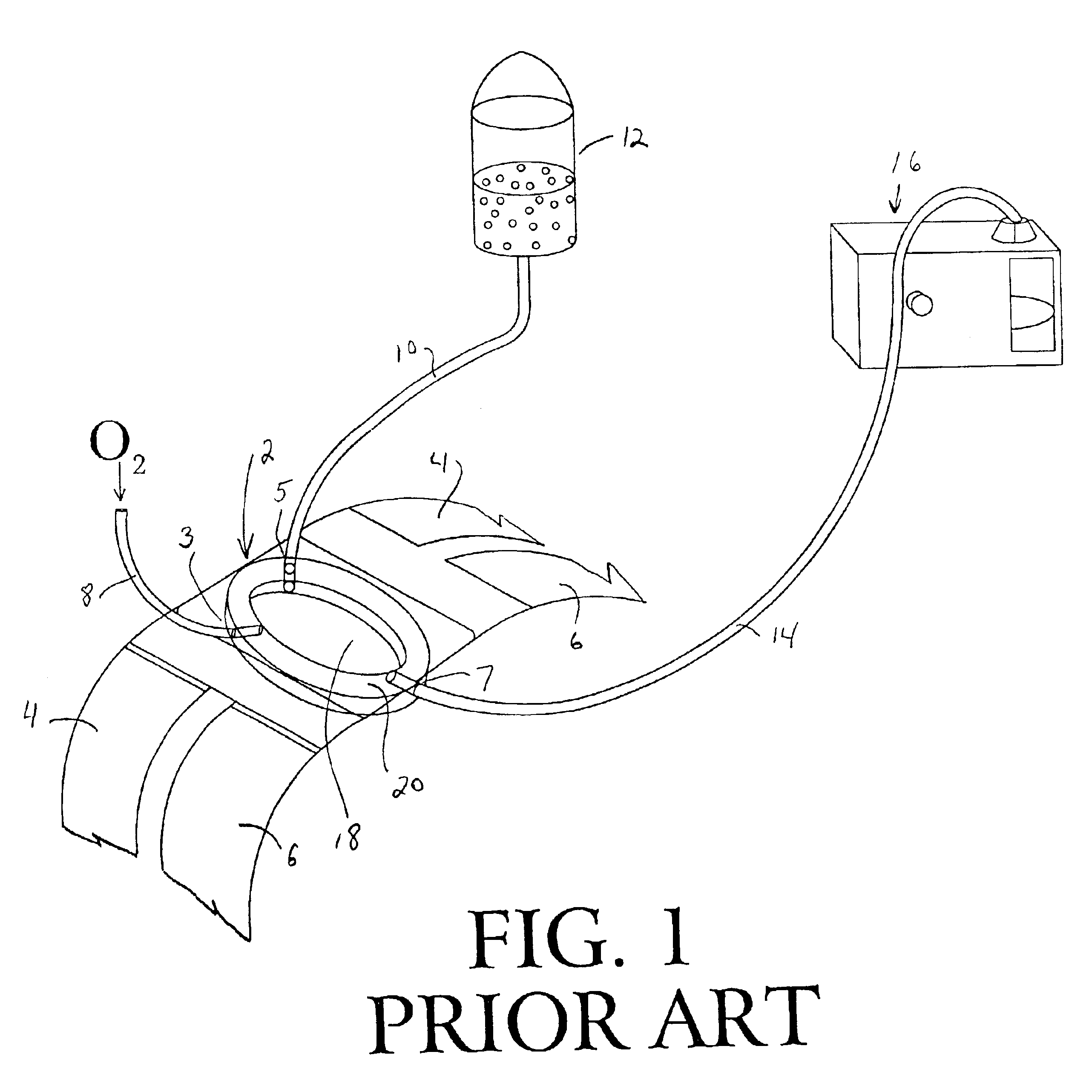 Irrigation dressing with a tubular dam