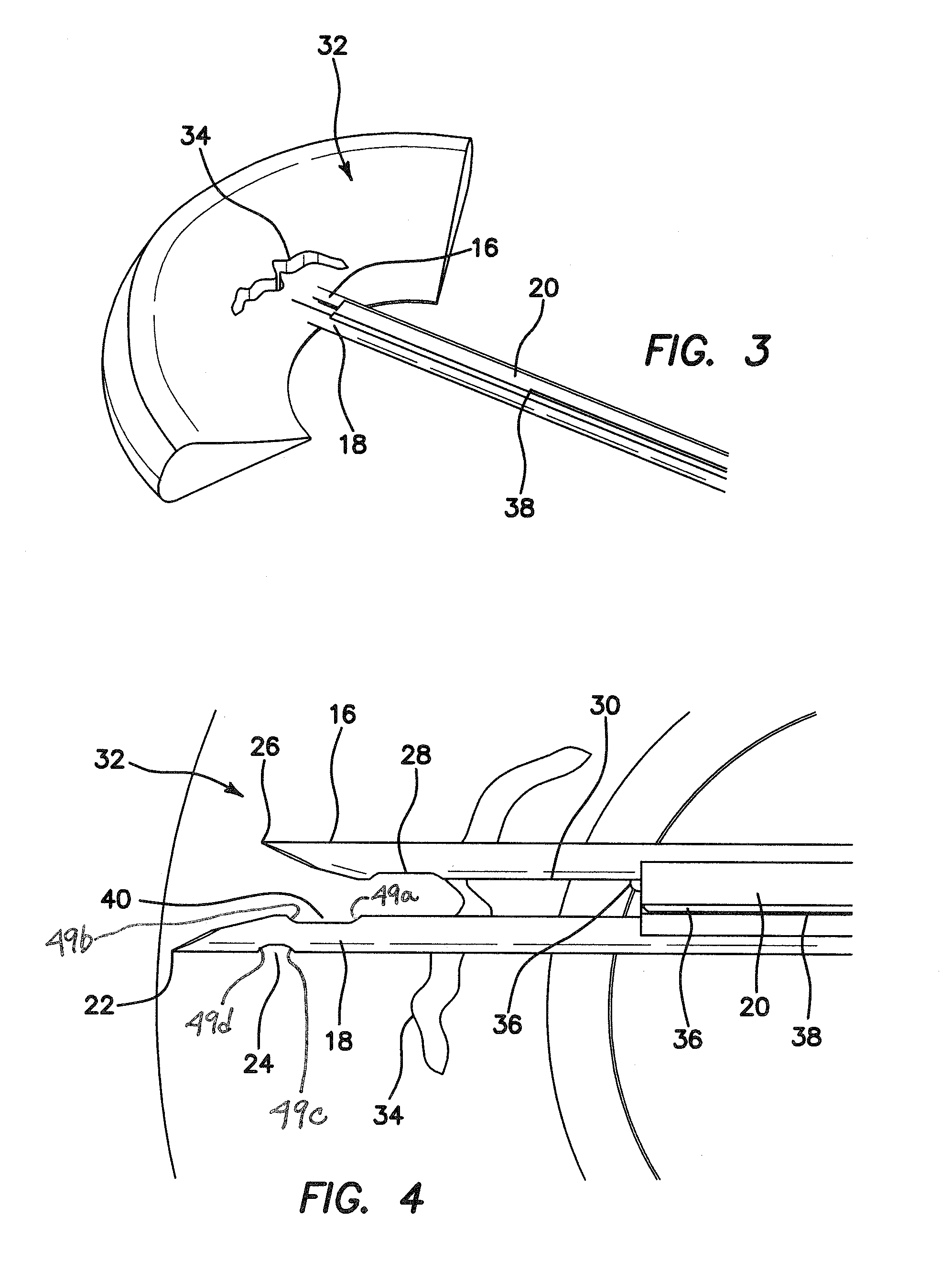 Arthroscopic meniscal repair systems and methods