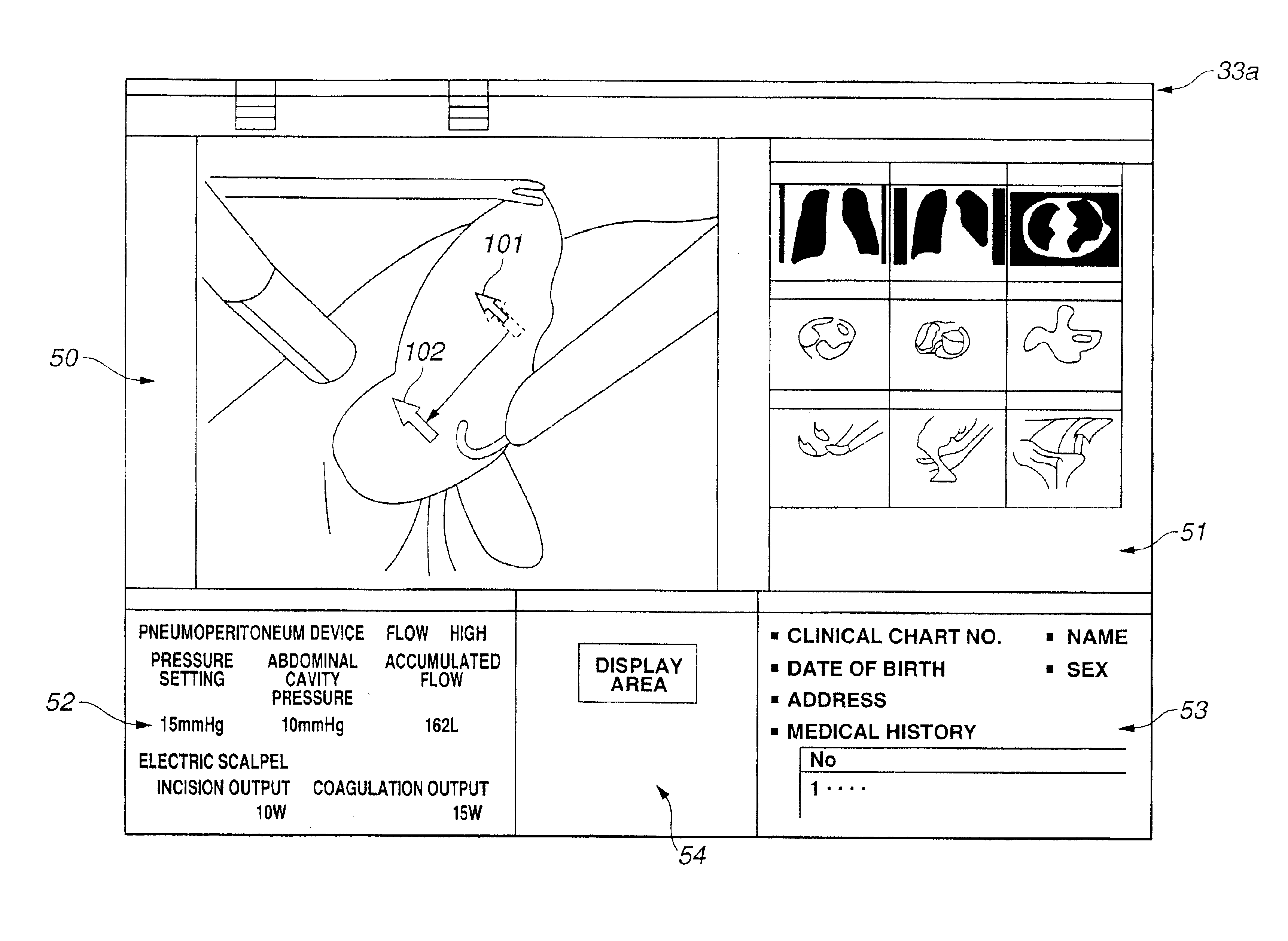 Surgery support system and surgery support method