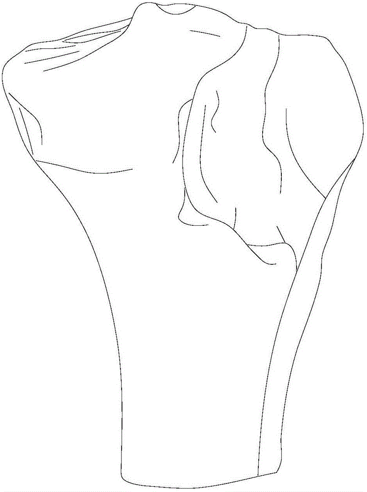 Method for designing and forming stiffness-controllable bone tumor defect repair implant