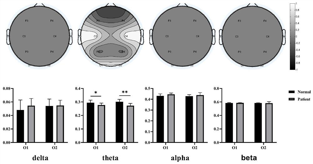 Autism electroencephalogram signal classification device based on resting-state brain network