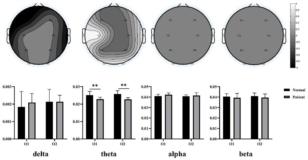 Autism electroencephalogram signal classification device based on resting-state brain network