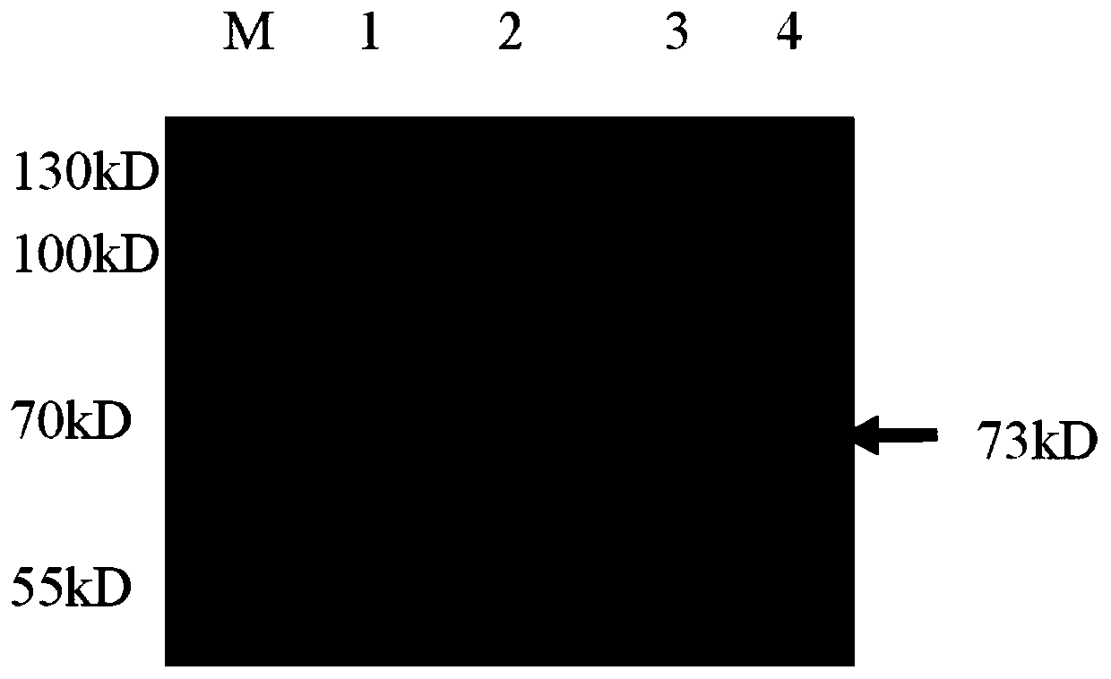 Kit for determination of GP73 based on latex-enhanced immunoturbidimetry and production and application methods of kit