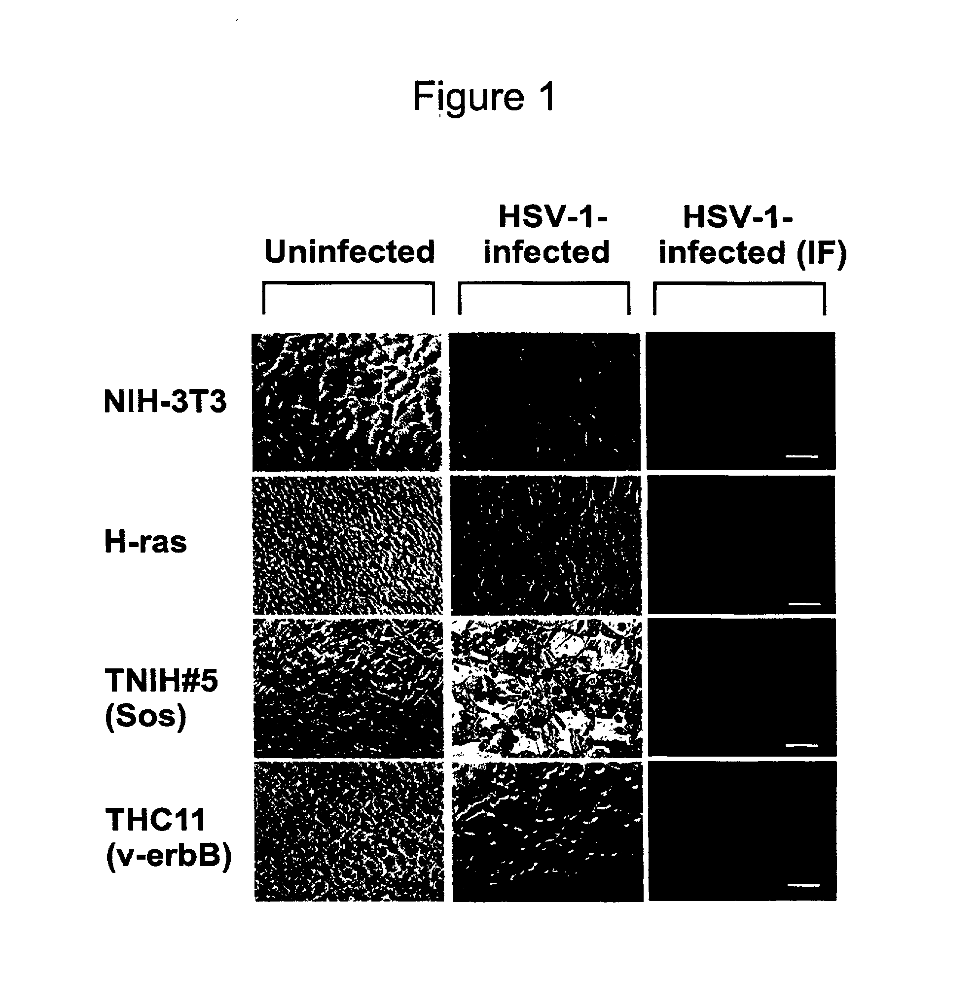 Diagnosis and treatment of herpes infections