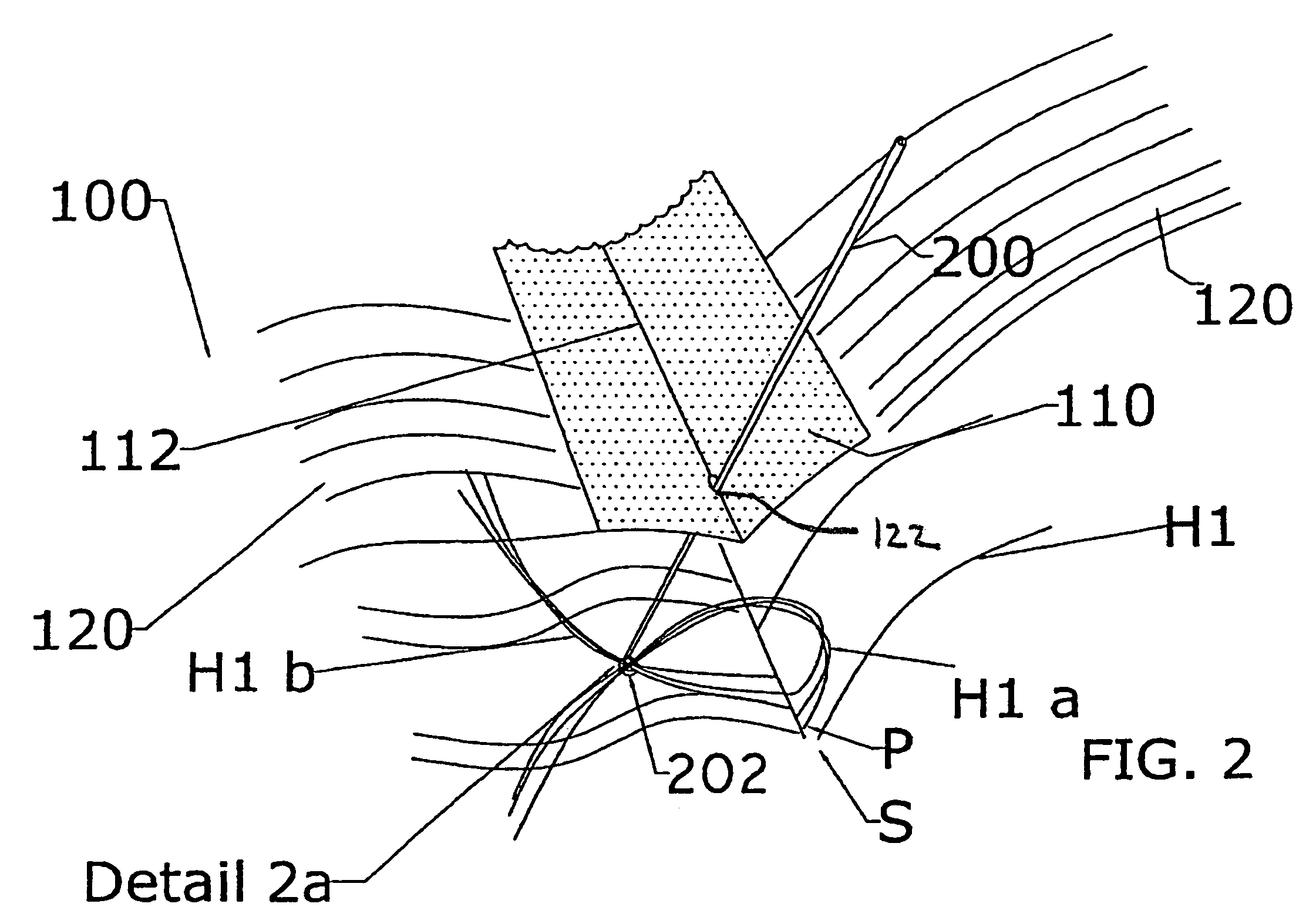 Method and apparatus for securing a hair extension