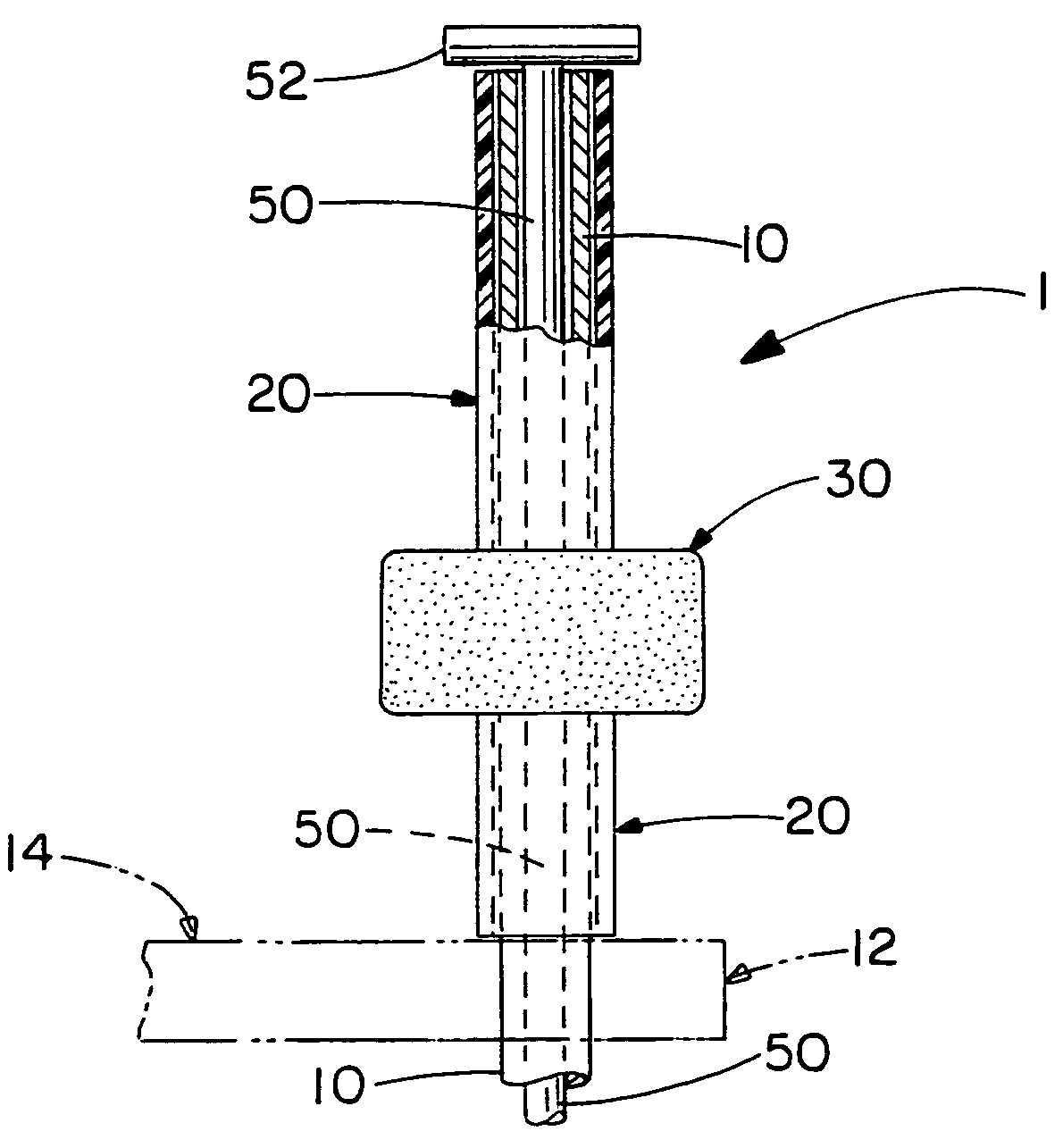 Floatable dock mooring article