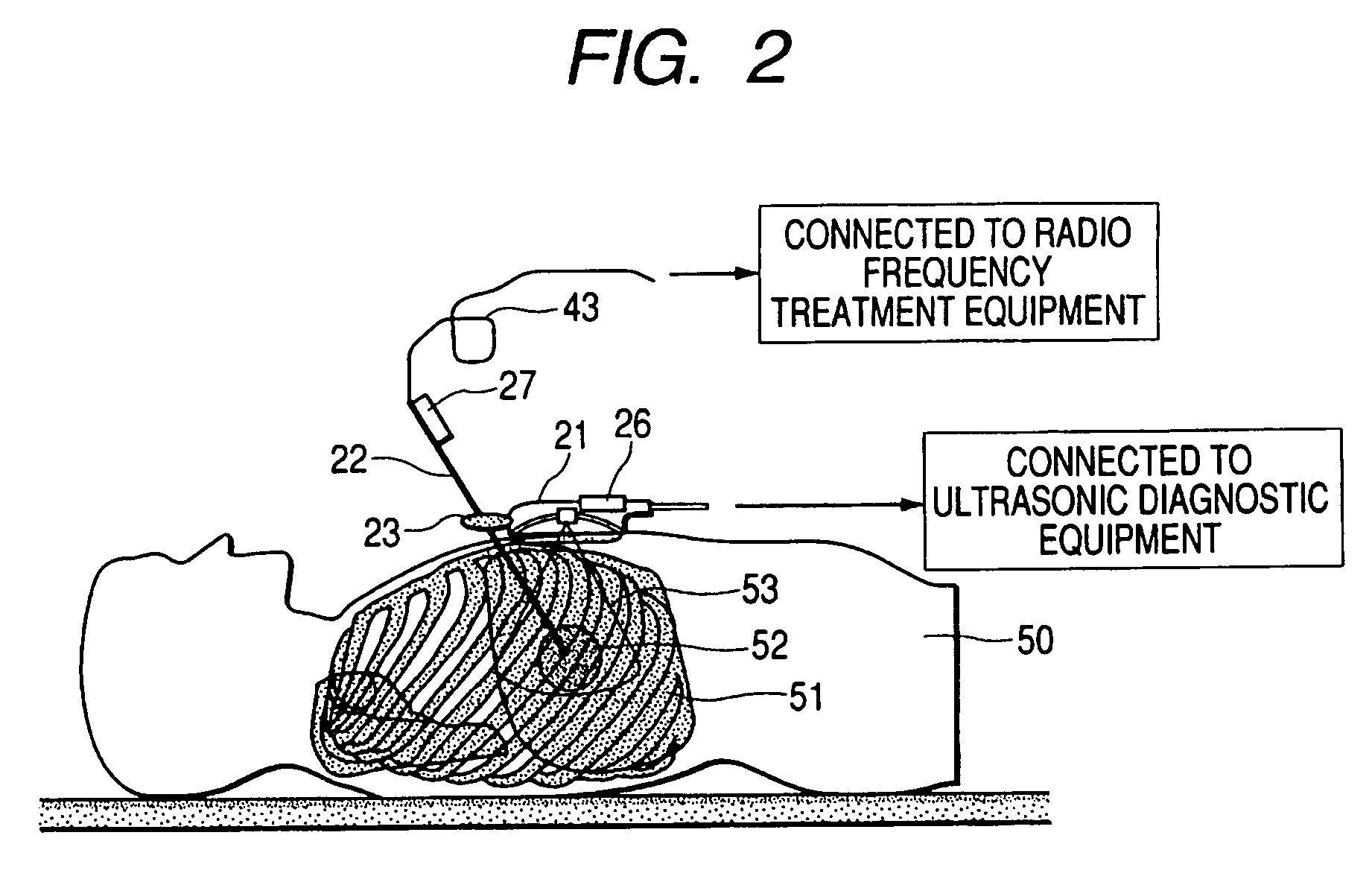 Ultrasonic diagnostic apparatus