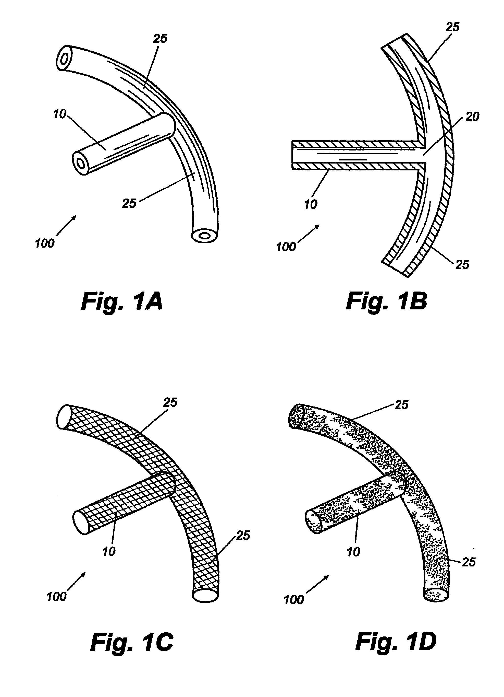 Dual drainage pathway shunt device and method for treating glaucoma