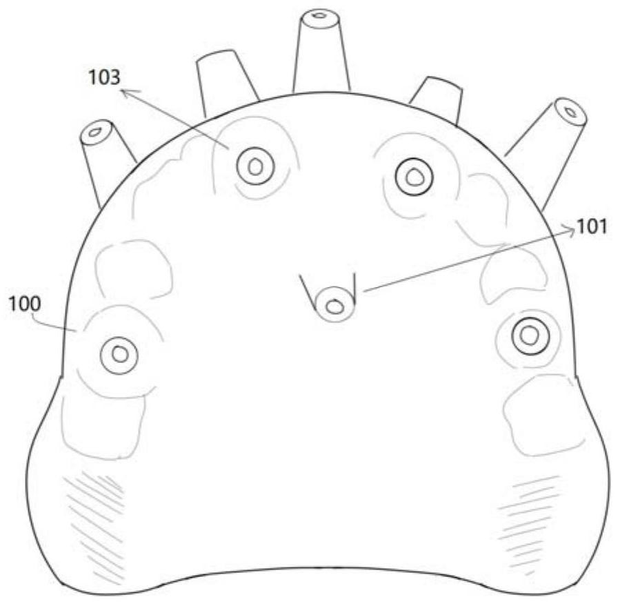 Occlusion-oriented implant surgery device for missing dentition and preparation method thereof