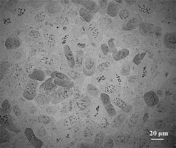 Method for preparing asparagus root tip cell chromosome metaphase split-phase specimen