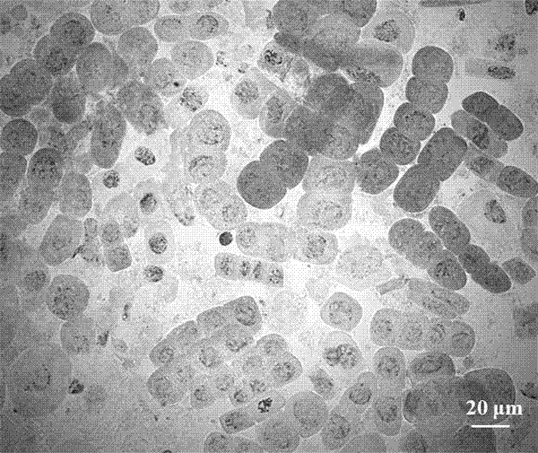 Method for preparing asparagus root tip cell chromosome metaphase split-phase specimen