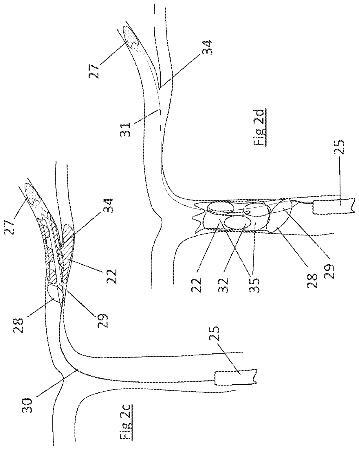 Clot retrieval device for removing occlusive clot from a blood vessel