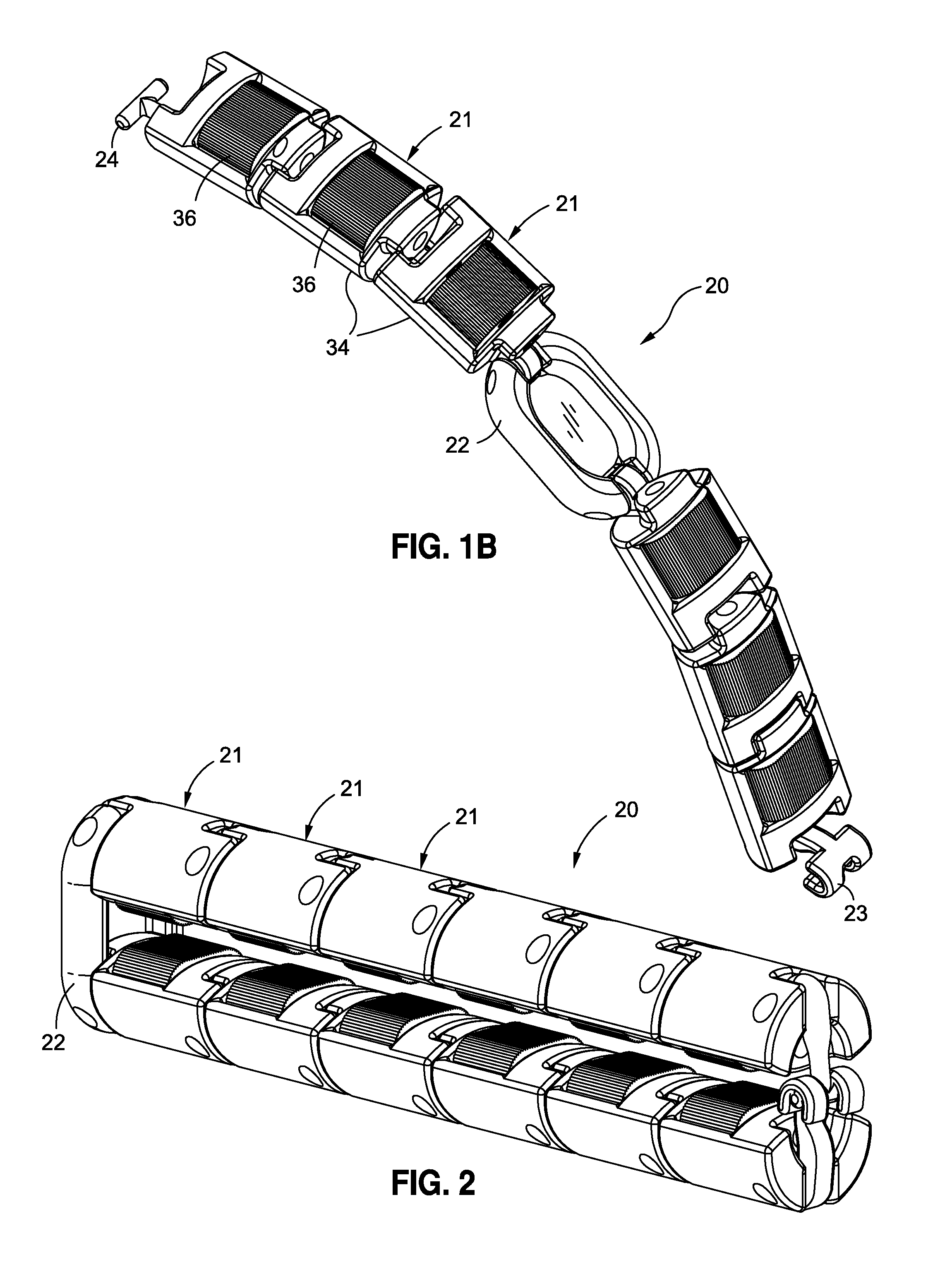 Articulated gastric implant clip