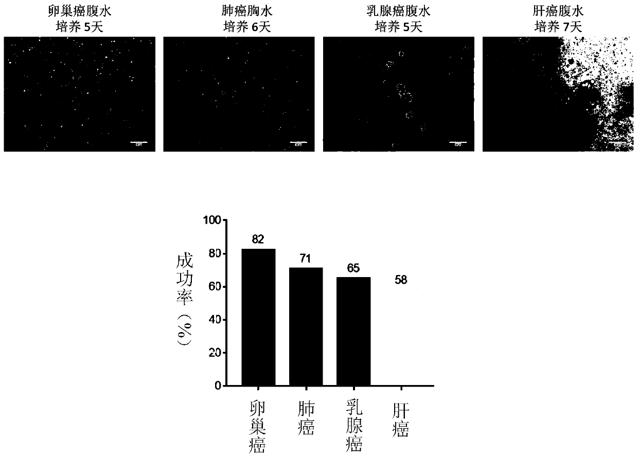 Pleuroperitoneal fluid type organ culture medium and method and drug sensitive testing method