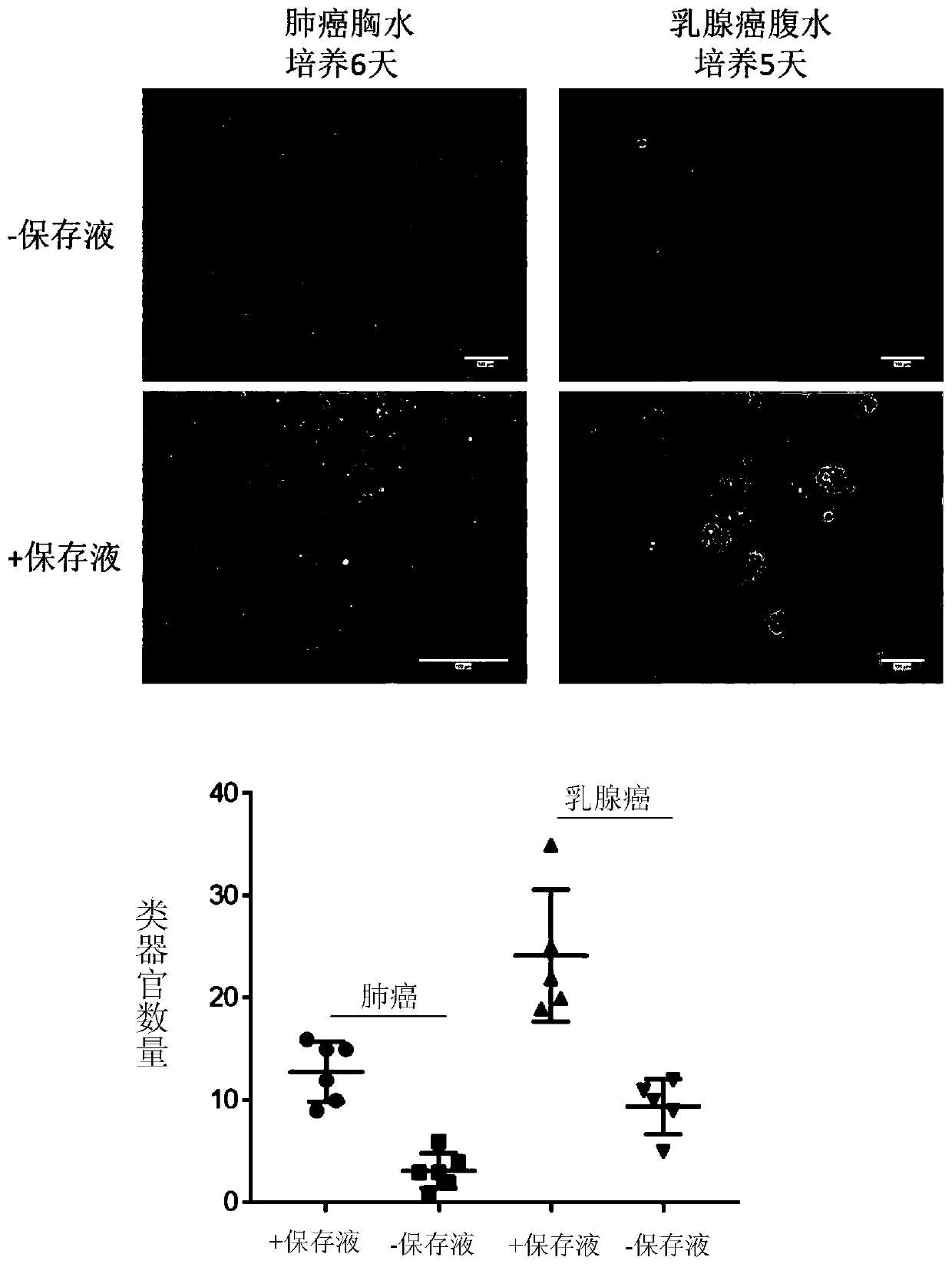 Pleuroperitoneal fluid type organ culture medium and method and drug sensitive testing method