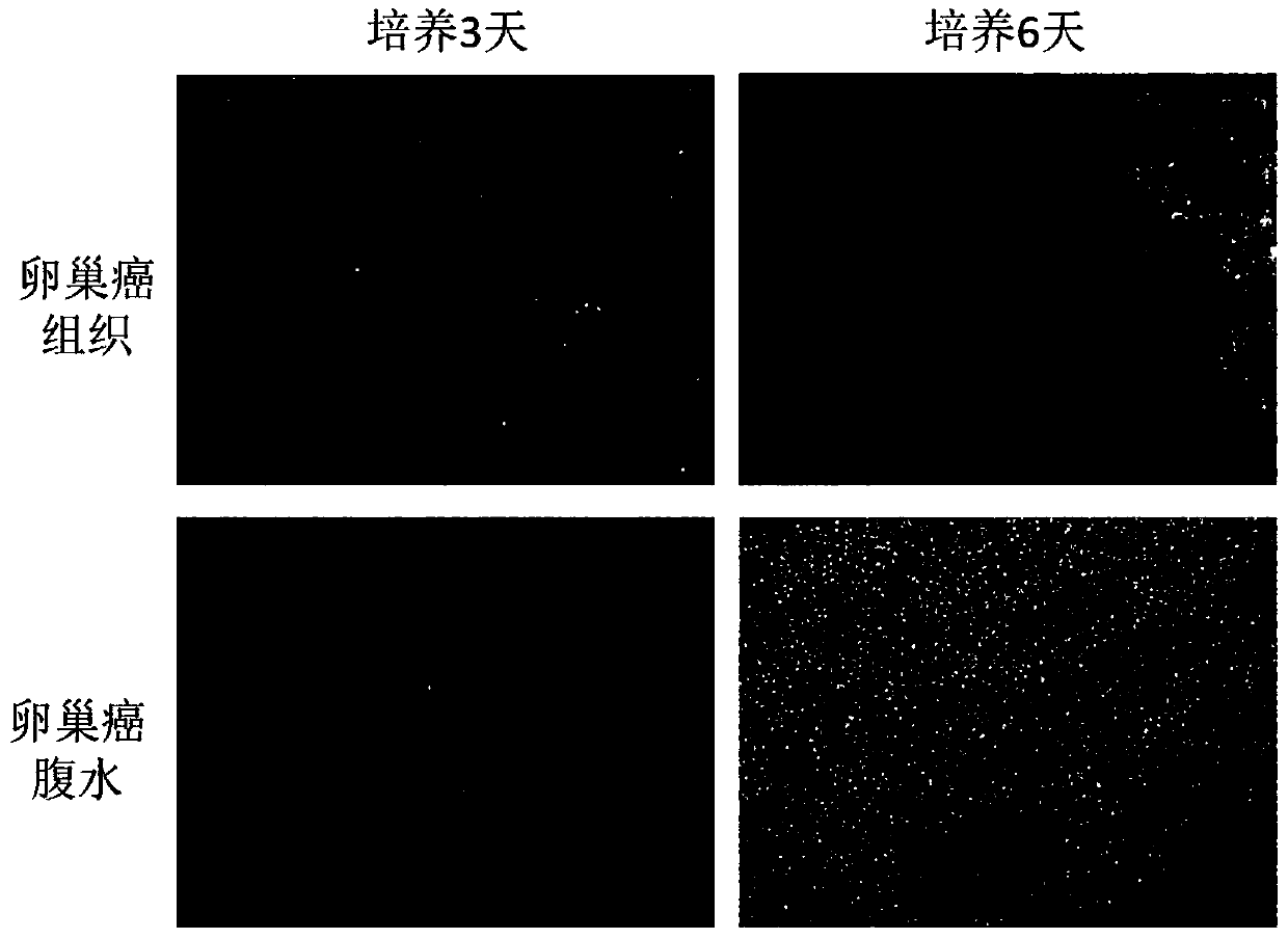 Pleuroperitoneal fluid type organ culture medium and method and drug sensitive testing method