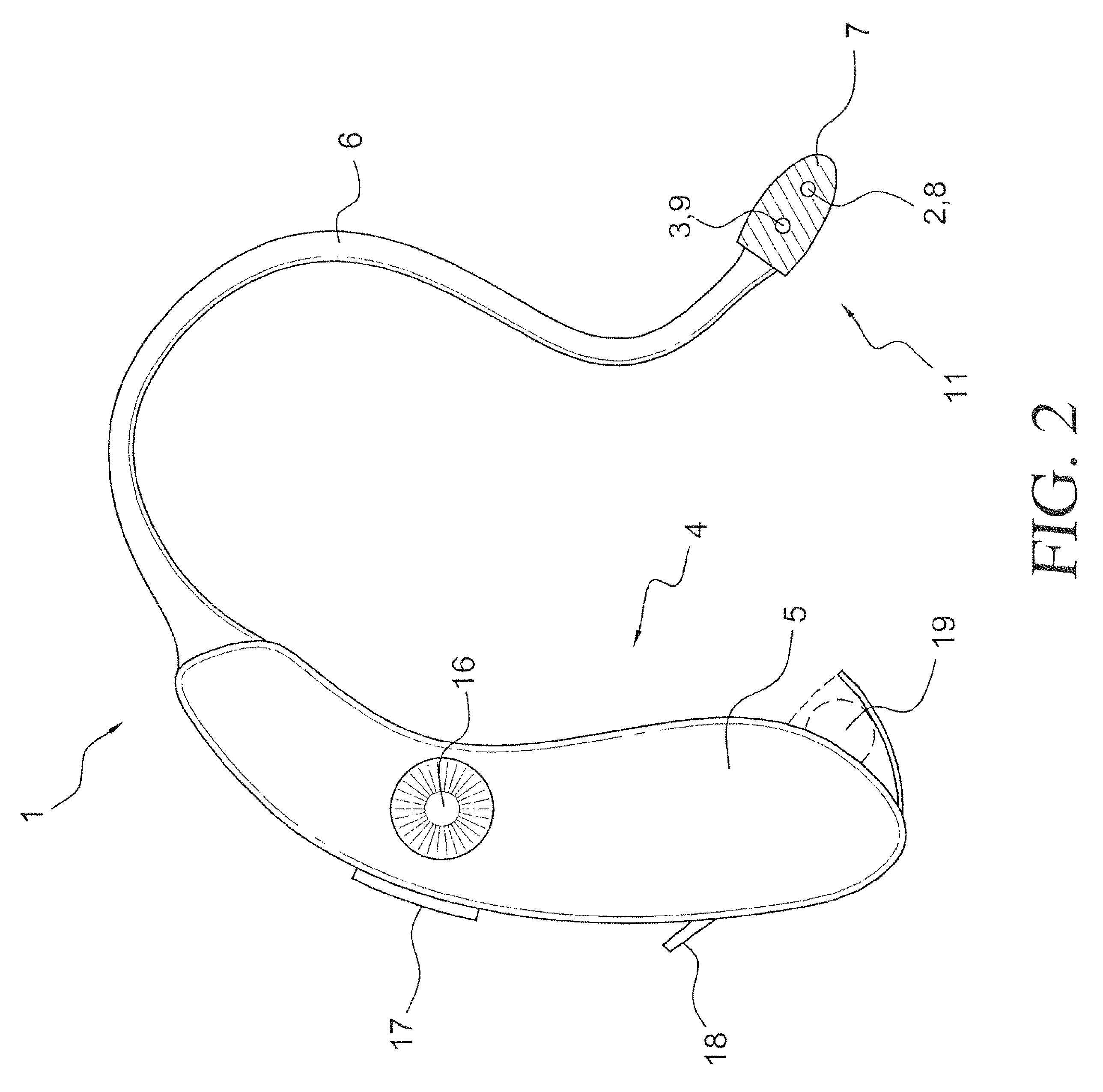 Method to enhance neural tissue operation