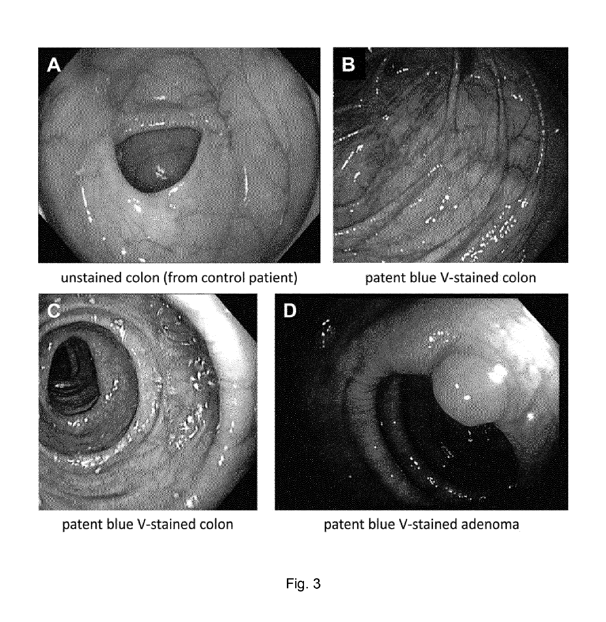 Shellac microcapsule formulations and compositions