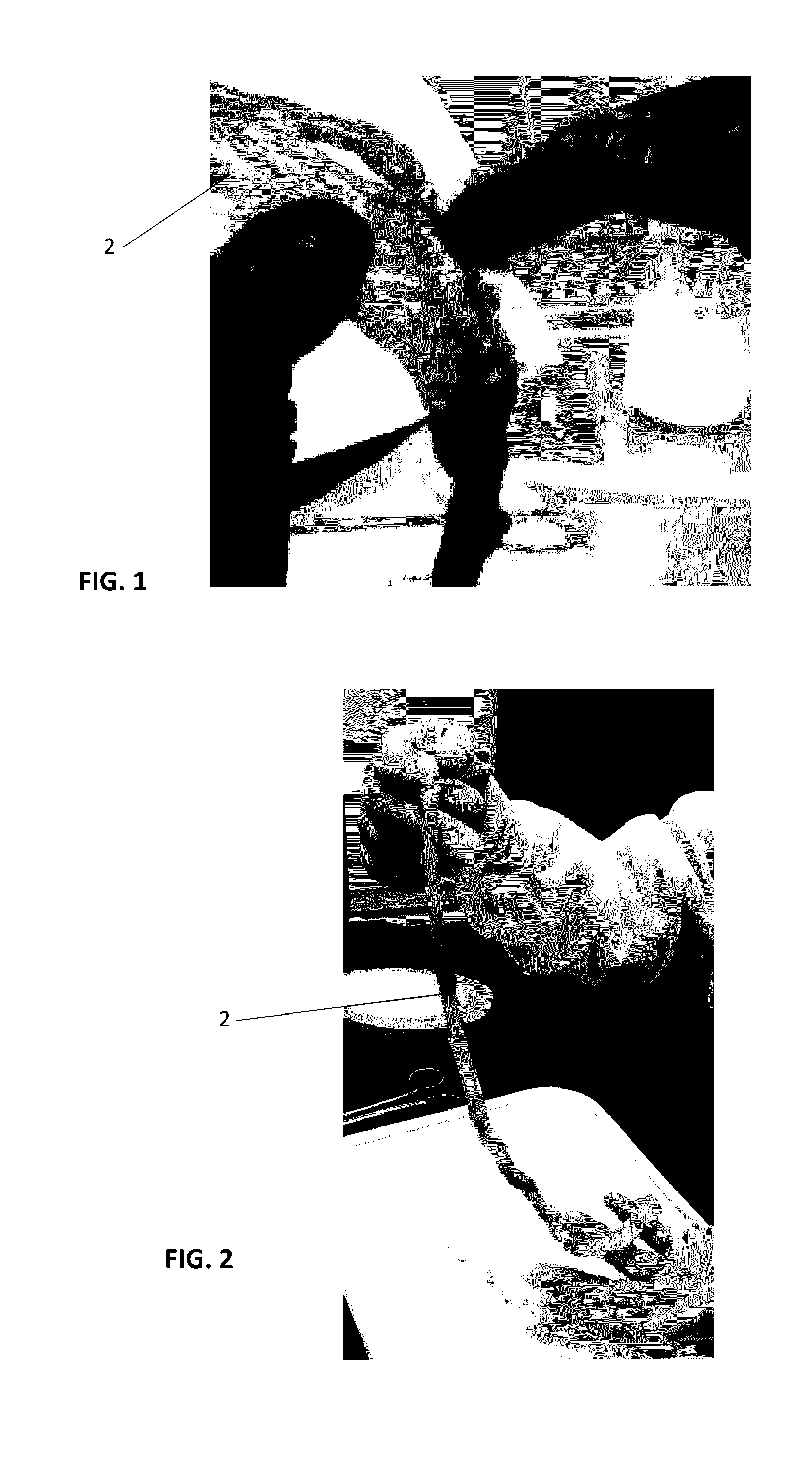 Shaped umbilical cord transplant product