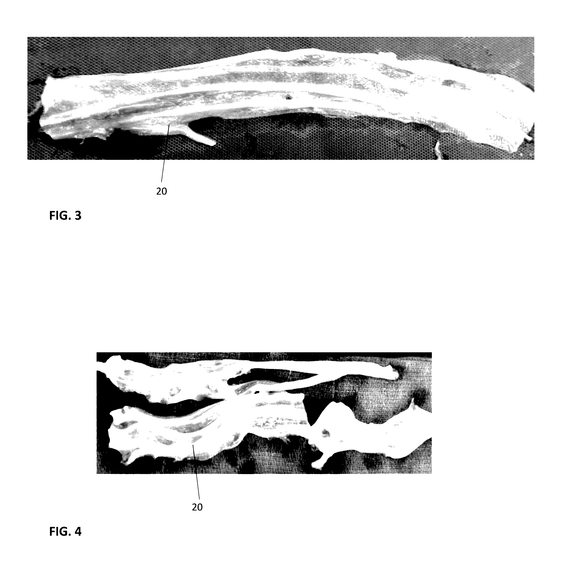 Shaped umbilical cord transplant product