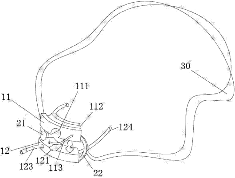 Trachea cannula tooth cushion