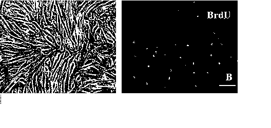 Method for co-culturing with nerve stem cell to inducing rASCs to be DA Neuron by Lmx1a mediation