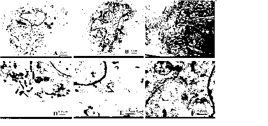 Method for co-culturing with nerve stem cell to inducing rASCs to be DA Neuron by Lmx1a mediation