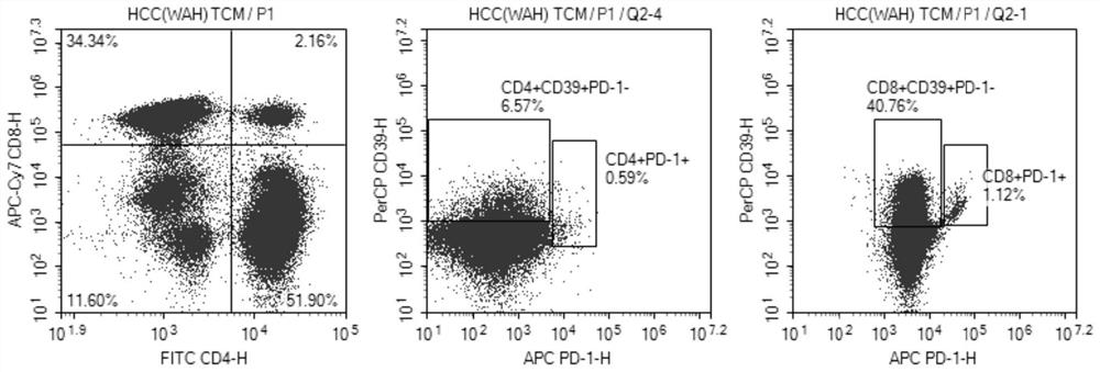 Application of memory lymphocyte population in the treatment of liver cancer