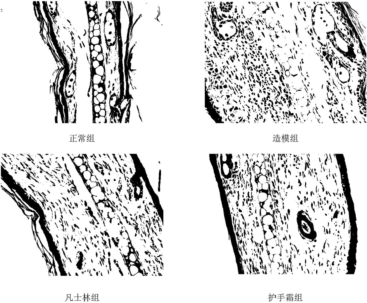 Hump fat hand cream with skin moisturizing and crack preventing effects and preparation method thereof