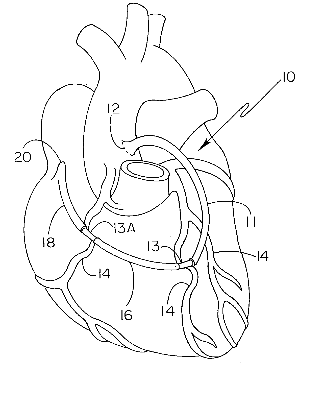 Grafted network incorporating a multiple channel fluid flow connector