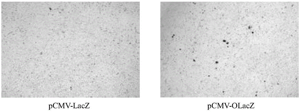 Codon optimized beta-galactosidase gene and application thereof