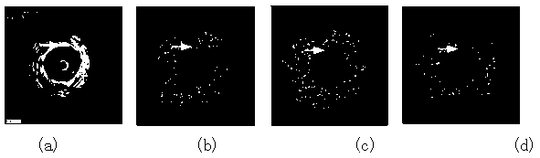 Method for estimating stress and strain of coronary artery blood vessel wall