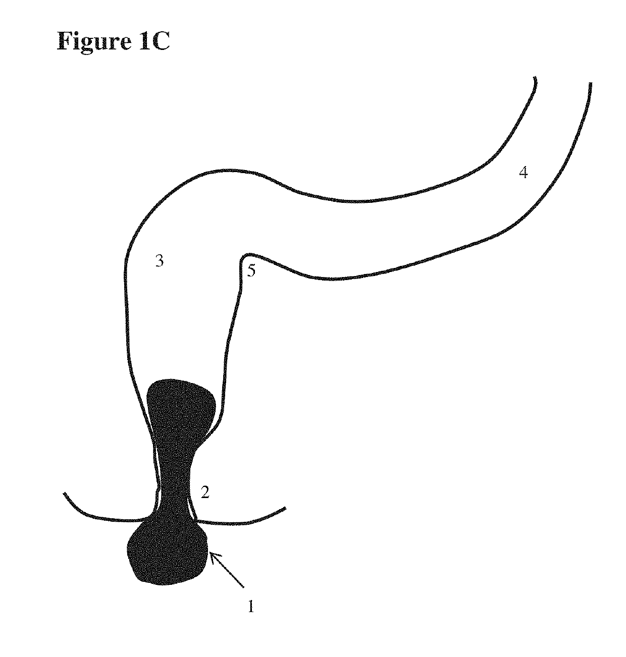 Devices for testing distal colonic and anorectal function