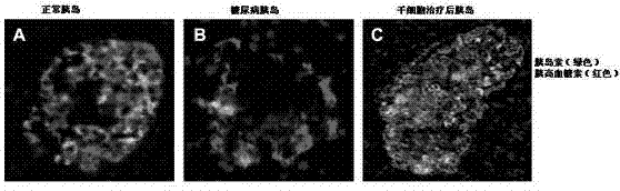 Mesenchymal stem cell injection, preparation method and application thereof in preparing medicine for treating diabetes