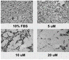 Novel p-methoxybenzyl-benzamide type compound for regulating estrogen-related receptor activity and medical use thereof