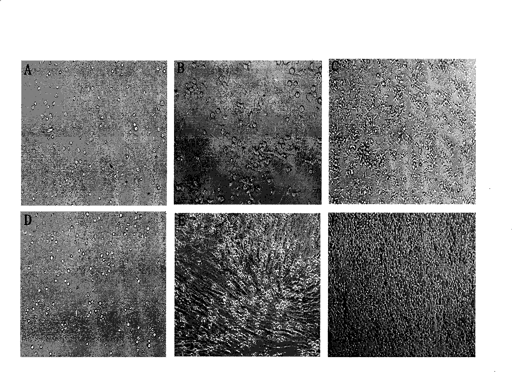 Immunologic tolerance dendritic cell, preparation method thereof and special culture medium