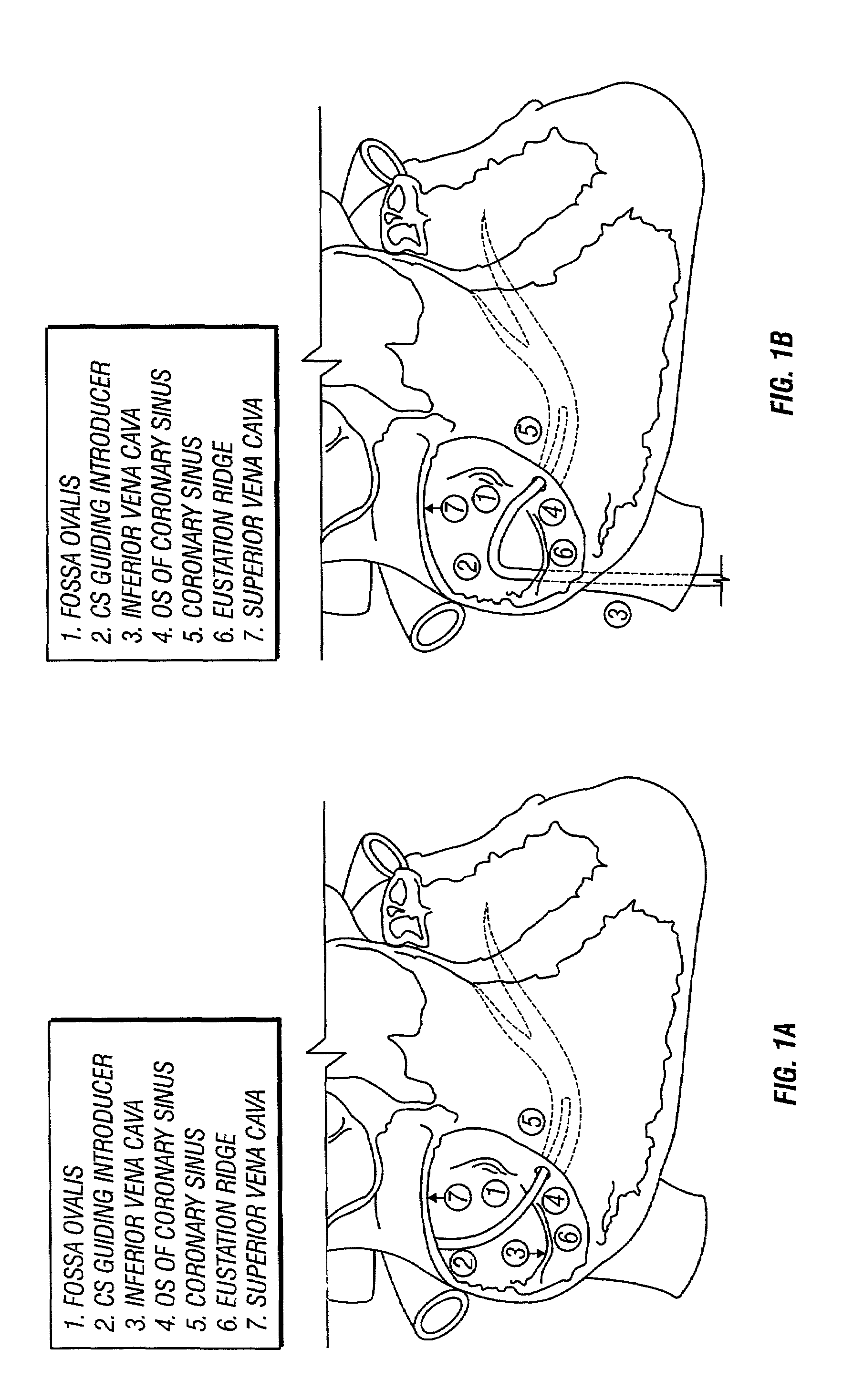 Telescopic, separable introducer and method of using the same