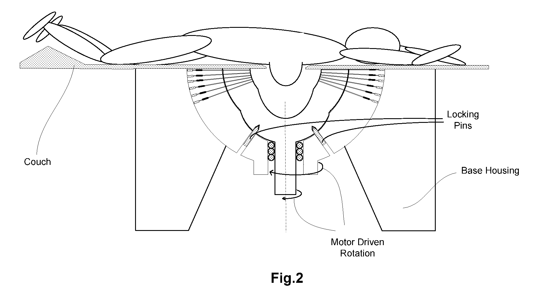 Method and equipment for image-guided stereotactic radiosurgery of breast cancer