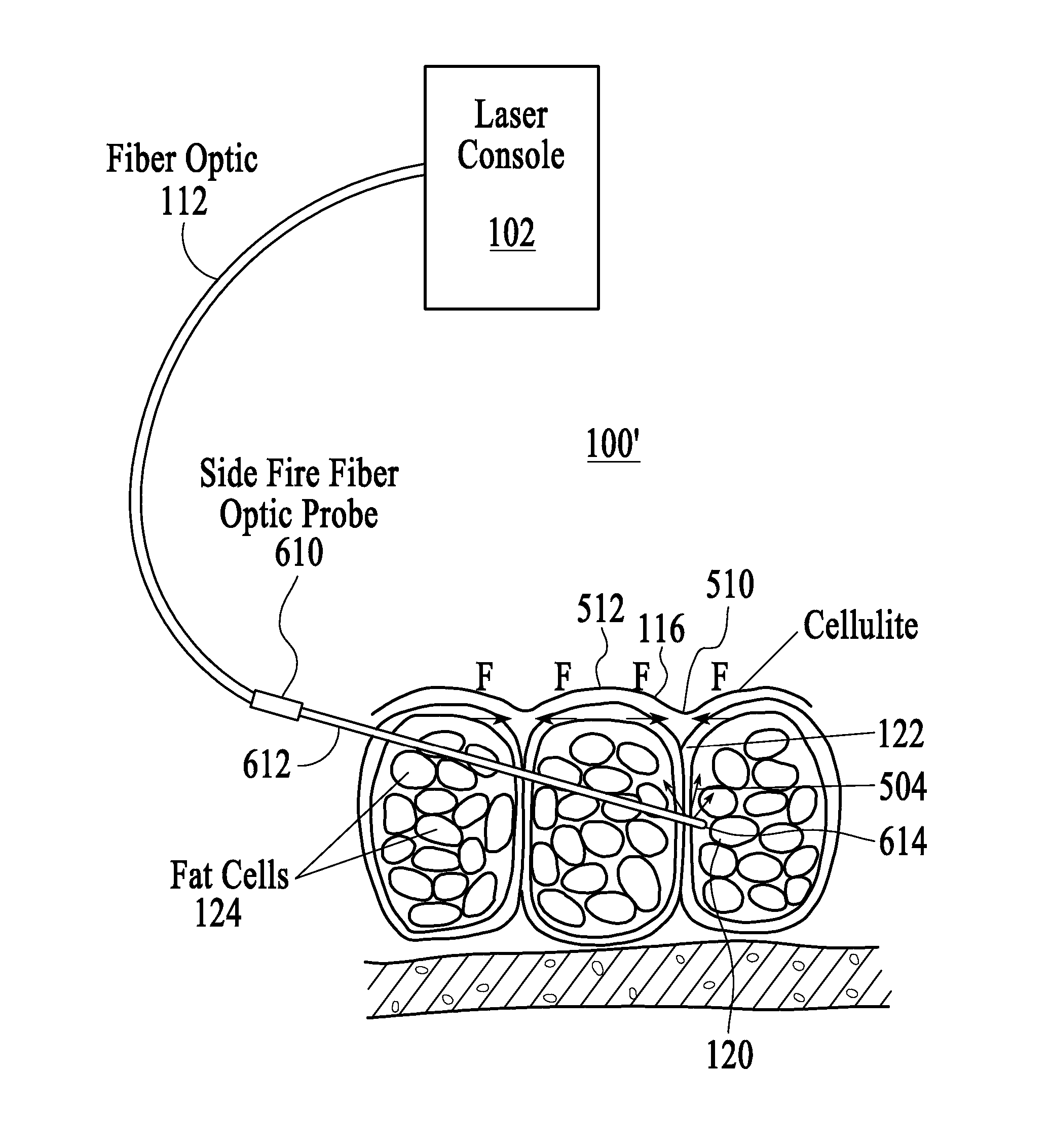 Treatment of cellulite and adipose tissue with mid-infrared radiation