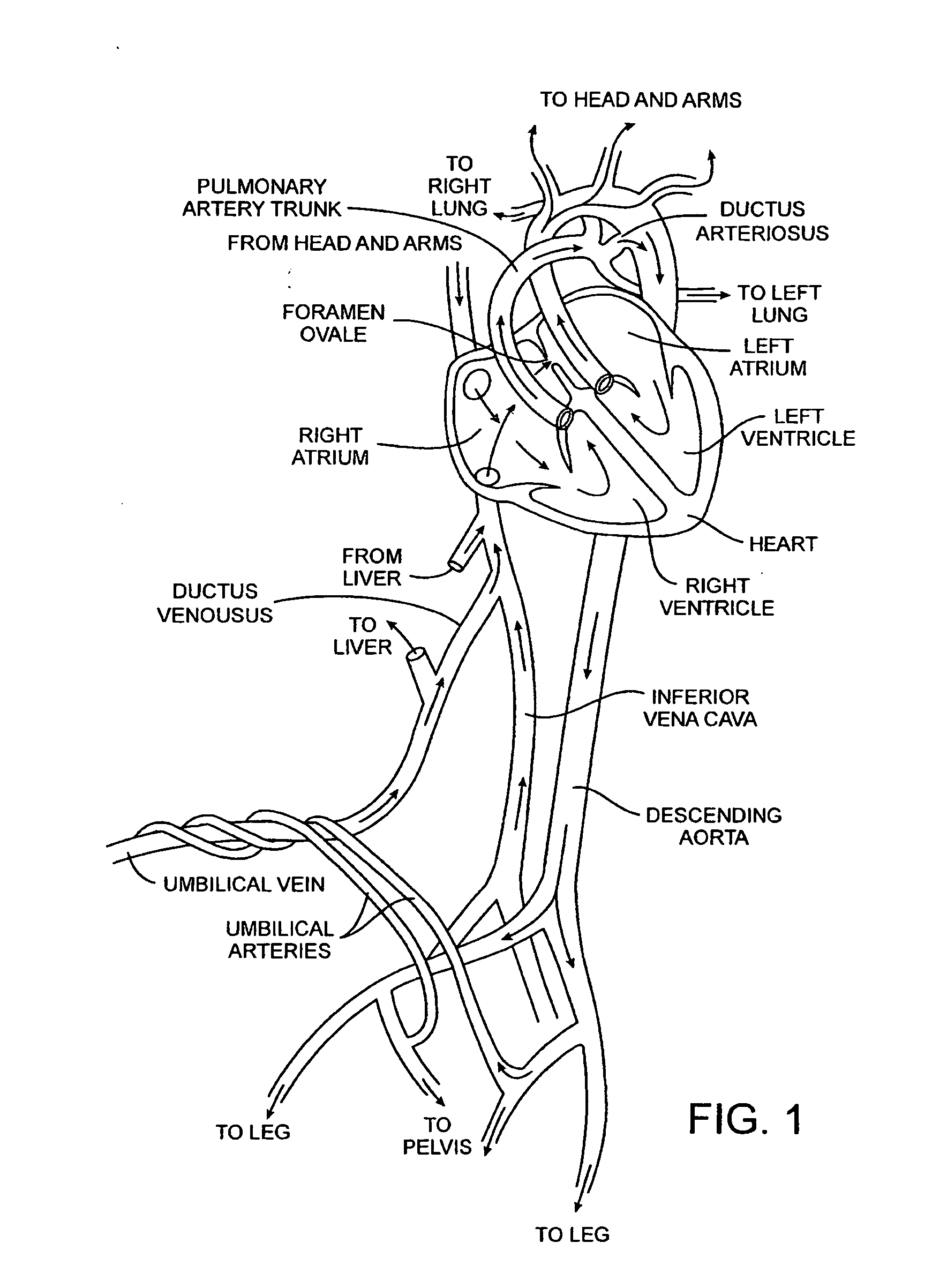 Methods and apparatus for treatment of patent foramen ovale