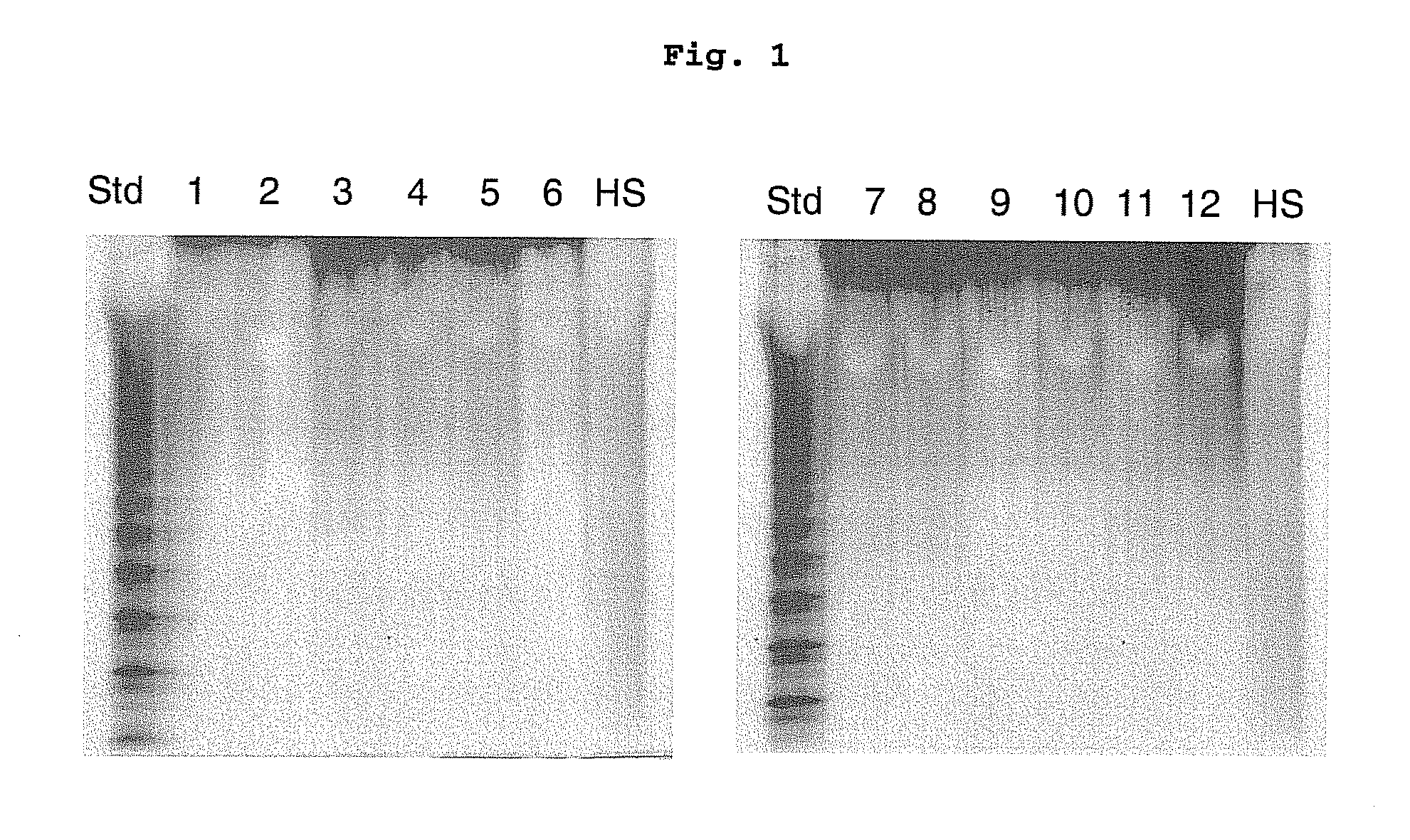 Biomarker and composition for diagnosis of preeclampsia and method for using the same