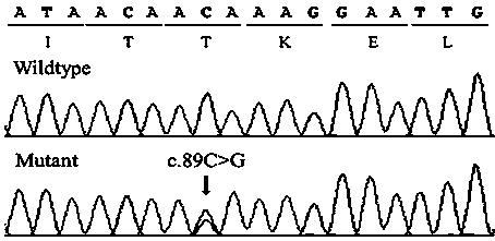 Missense mutation affecting human inherited arrhythmogenic disease auxiliary diagnosis and clinical intervention and application of missense mutation